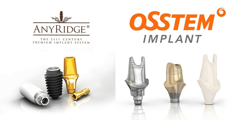 Any ridge, Osstem implant