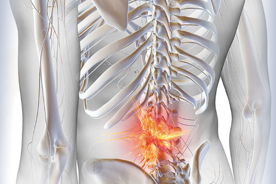 Невралгия спины - диагностика и лечение в Клинике А.Н. Бакланова