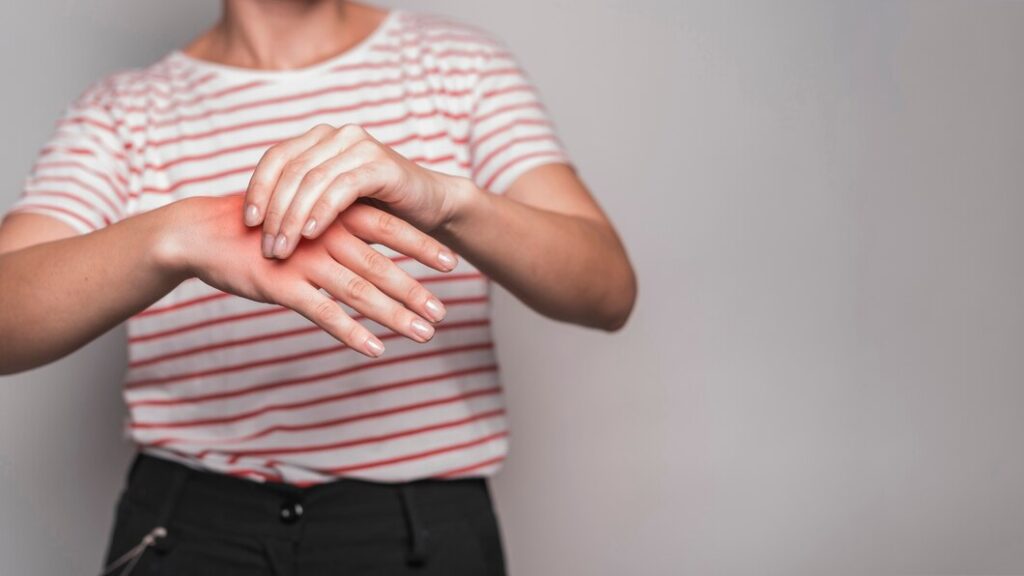 Лечение артроза кистей рук