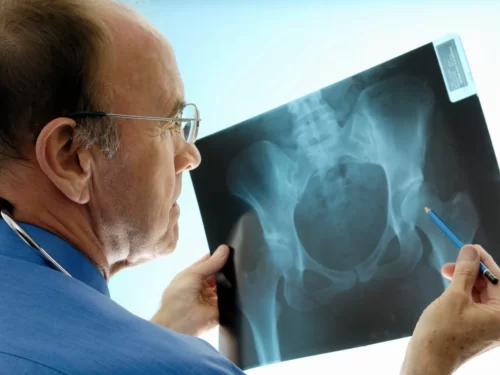 Диагностика переломов: от рентгена до КТ