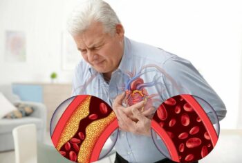 Нарушение кровоснабжения сердечной мышцы