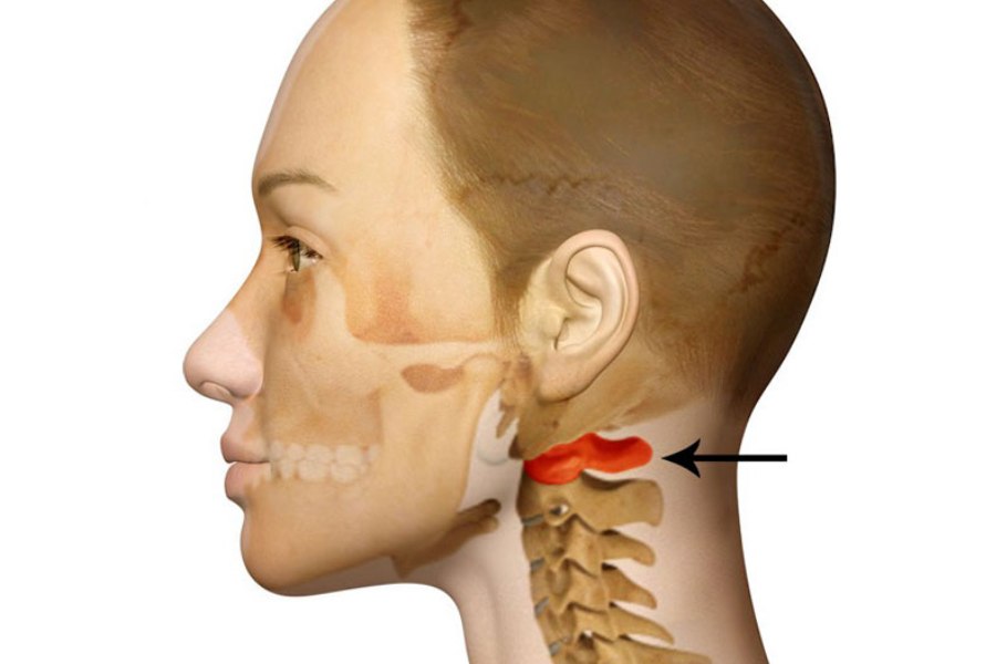 Treatment of cervical vertebrae displacement